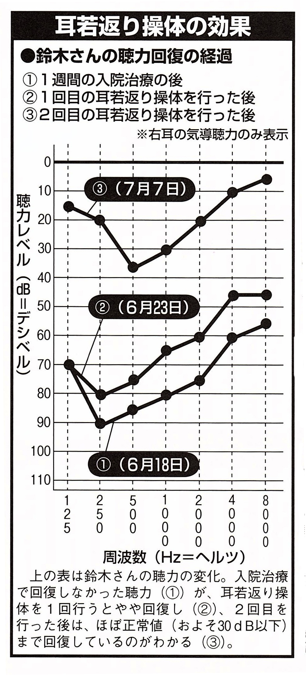 聴力検査